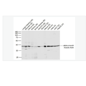 Anti-alpha-肌動(dòng)蛋白α/α-SMA/α Actin單克隆抗體