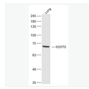 Anti-HSP70 antibody-熱休克蛋白70抗體