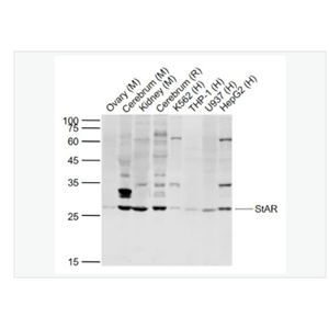 Anti-StAR antibody  -促黃體激素誘導蛋白抗體