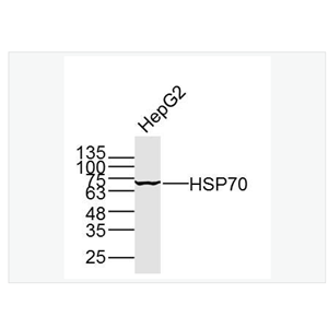 Anti-HSP70  antibody-熱休克蛋白-70單克隆抗體