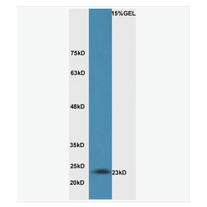 Anti-Bak antibody-Bcl-2同源拮抗劑抗體