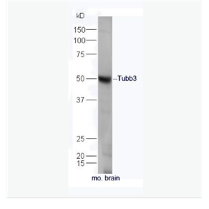 Anti-Tubb3 antibody-微管蛋白β3抗體