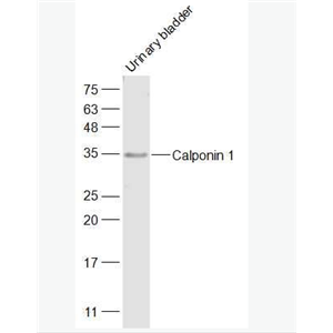  Calponin 1 鈣調(diào)節(jié)蛋白-1抗體