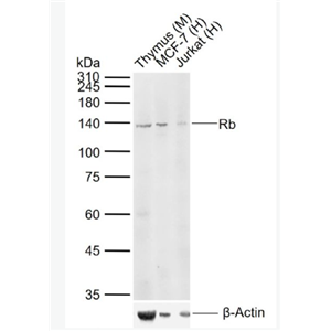 Anti-Rb antibody -成視網(wǎng)膜細(xì)胞瘤基因抗體