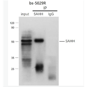 Anti-SAHH antibody -S腺苷L-同型半胱氨酸水解酶抗體