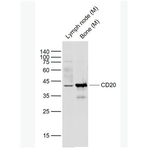 Anti-CD20 antibody -CD20抗體