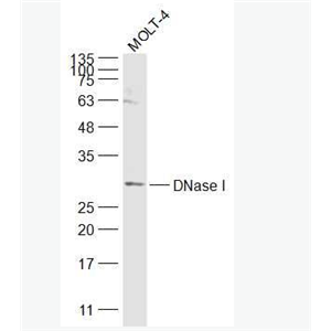 Anti-DNase I antibody-脫氧核糖核酸酶1抗體