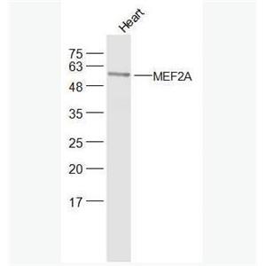 Anti-DMEF2A  antibody-肌細(xì)胞增強因子2抗體