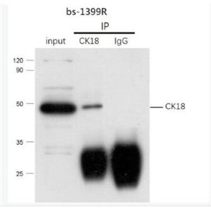 Anti-E2F4 antibody-轉(zhuǎn)錄因子E2F-4抗體