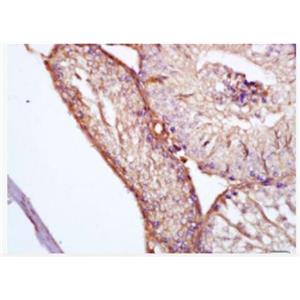 Anti-Clusterin antibody-載脂蛋白J（APOJ）抗體