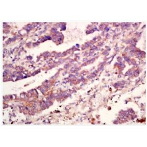 Anti-MMP10 antibody-基質(zhì)金屬蛋白酶-10抗體