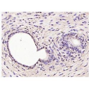 Anti-RSL1D1  antibody-細(xì)胞衰老抑制基因抗體