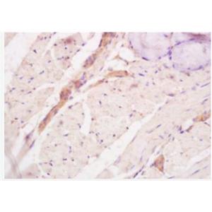 Anti-Tenascin C  antibody-細(xì)胞粘合素/腱糖蛋白-C/固生蛋白抗體