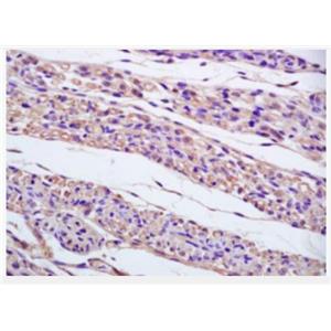 Anti-gamma tubulin antibody-基微管蛋白γ/Tubulin γ抗體