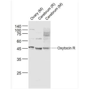 Anti-Oxytocin R  antibody-催產(chǎn)素受體(縮宮素受體)抗體