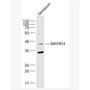 Anti-P38 MAPK/ MAPK14 antibody-絲裂原活化蛋白激酶p38α抗體