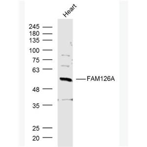 Anti-FAM126A antibody-髓鞘缺陷相關(guān)蛋白抗體