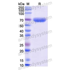 Human MMP9 Antibody (SAA0116) FHD06810