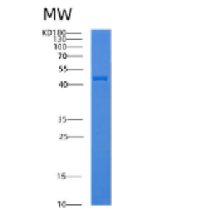 Recombinant Human ADPRH Protein