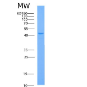 Recombinant Human ADH1C Protein