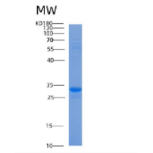 Recombinant Human ACBD6 Protein