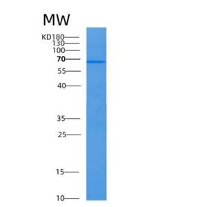 Recombinant Human ALB Protein