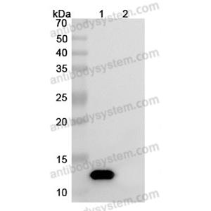 中和抗體-Human IL8/CXCL8 (Iv0023) VHC79101