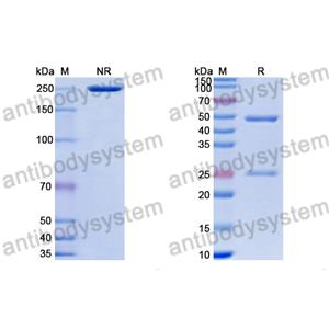 Anti-HRSV-A F/Fusion glycoprotein F0 Antibody (191E4#) (DVV08401)