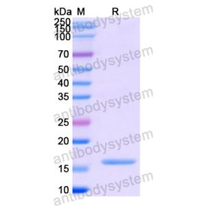 Recombinant Human CCL25/TECK, N-His