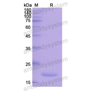 Recombinant Human PLA2G10, N-His