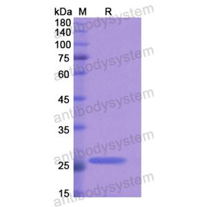 Anti-HRSV-A F/Fusion glycoprotein F0 Antibody (D25)