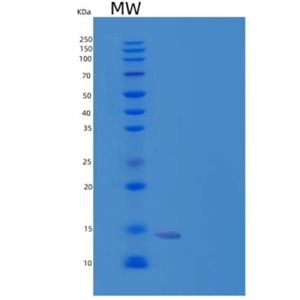 Recombinant Human Oncomodulin-1/OM Protein(N-6His)