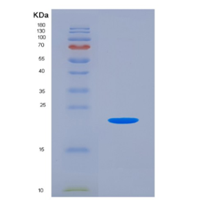 Eukaryotic Colony Stimulating Factor 2, Granulocyte Macrophage (GM-CSF).