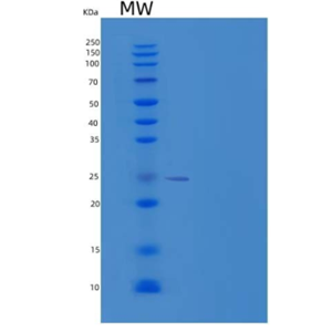 Recombinant Human Thymidylate Kinase/DTYMK Protein(C-6His)