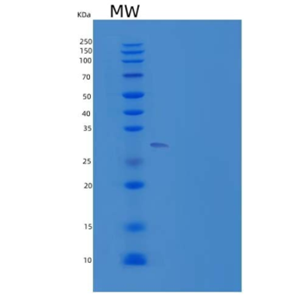 Recombinant Mouse Granzyme B(G,H)/GZMB Protein(C-6His)