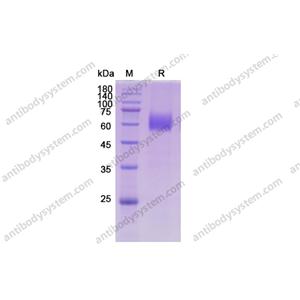 Recombinant Human CD116/CSF2RA, C-His