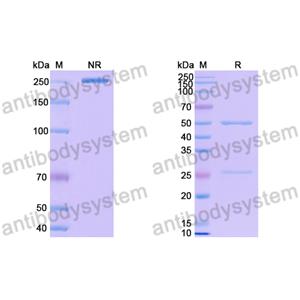 Human RAGE Antibody (XT-M4) RHH01901