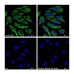 aladdin 阿拉丁 Ab179002 Goat Anti-Mouse IgG H&L (Biotin) Secondary Antibody; Goat Anti-Mouse IgG H&L (Biotin); WB, ELISA, IF, Flow