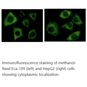 Cytokeratin (Pan)