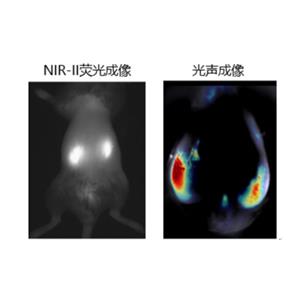 腎纖維化診斷 NIR-II AIE 探針