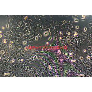 人肝癌細(xì)胞Hep-G2/2.2.15