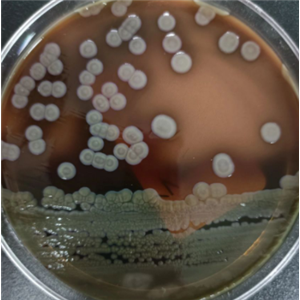 Apophysomyces Trapeziformis