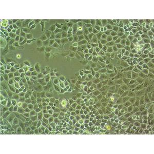 A-172 Cells人腦膠質(zhì)母細胞系(提供STR圖譜)