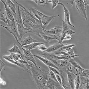 MRC-5 Cells人胚肺復(fù)蘇細(xì)胞系(有STR鑒定圖譜)