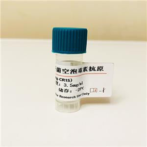 幽門螺桿菌空泡毒素抗原；幽門螺桿菌空泡細(xì)胞毒素(VacA)；幽門螺桿菌鞭毛抗原 （H）