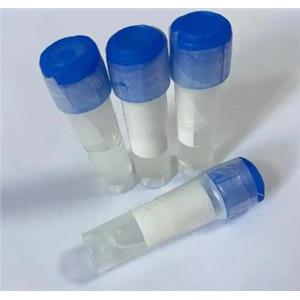 磷酸化tau217蛋白抗體、Tau(Thr217) Antibody、p-tau217 Antibody