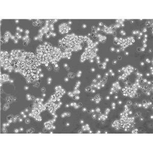 NCI-H1975 Cells#人肺腺癌細胞系種子庫|完全培養(yǎng)基|STR圖譜