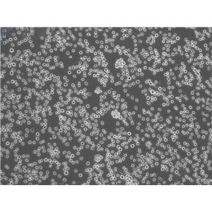 MM1-S Cell人免疫球蛋白lambda骨髓瘤懸浮細胞