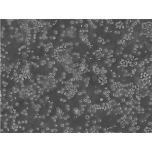 Ball 1 Cell人B淋巴細胞急性白血病懸浮細胞